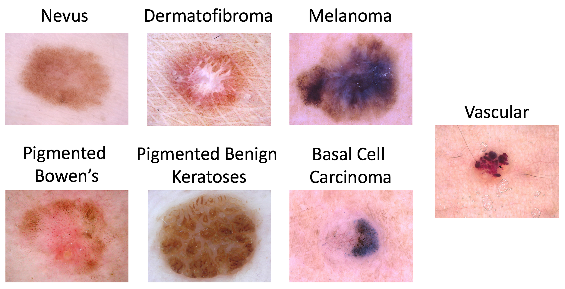 Isic 2019 Skin Lesion Analysis Towards Melanoma Detection Task 2 Daisylabs 8058